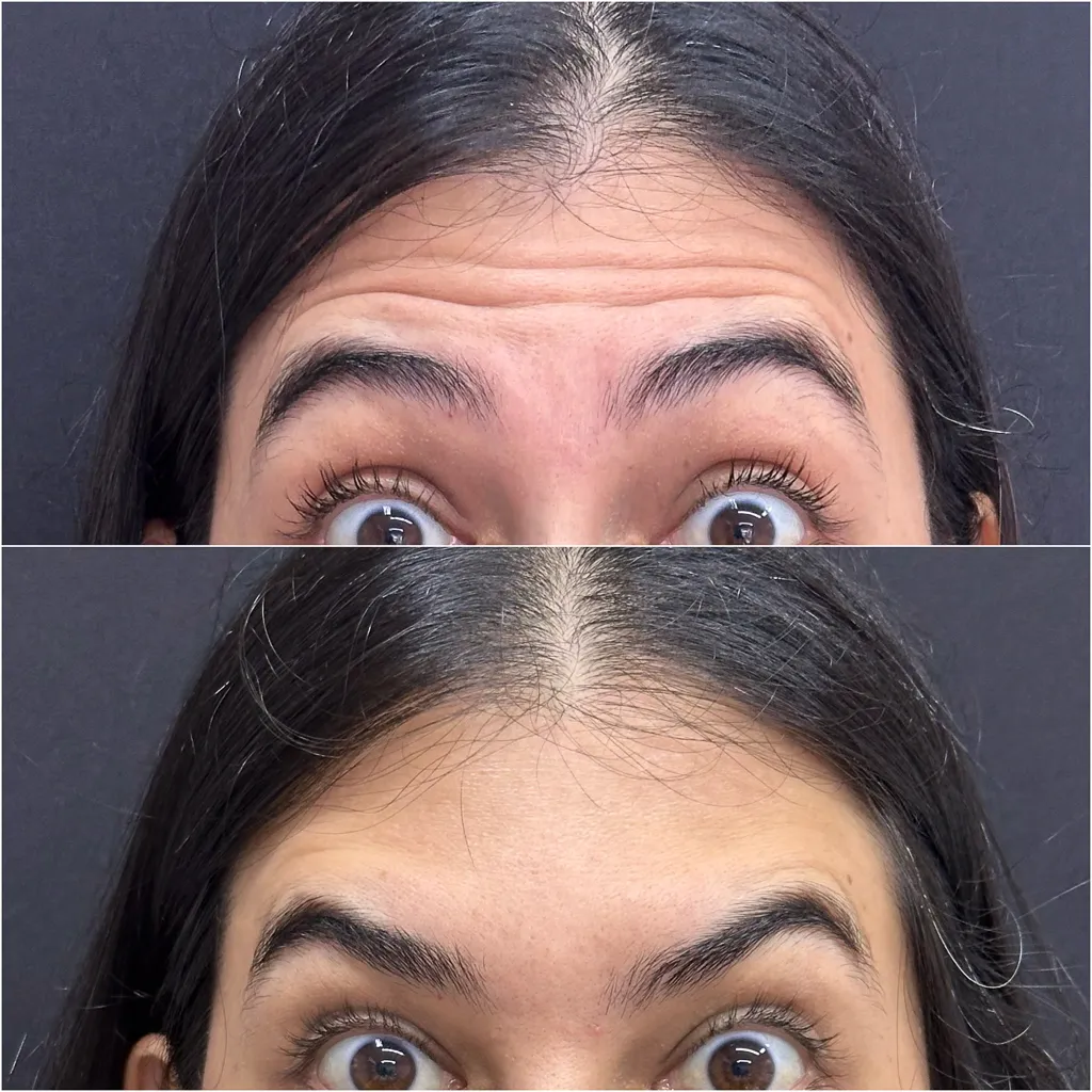 FULLFACE
