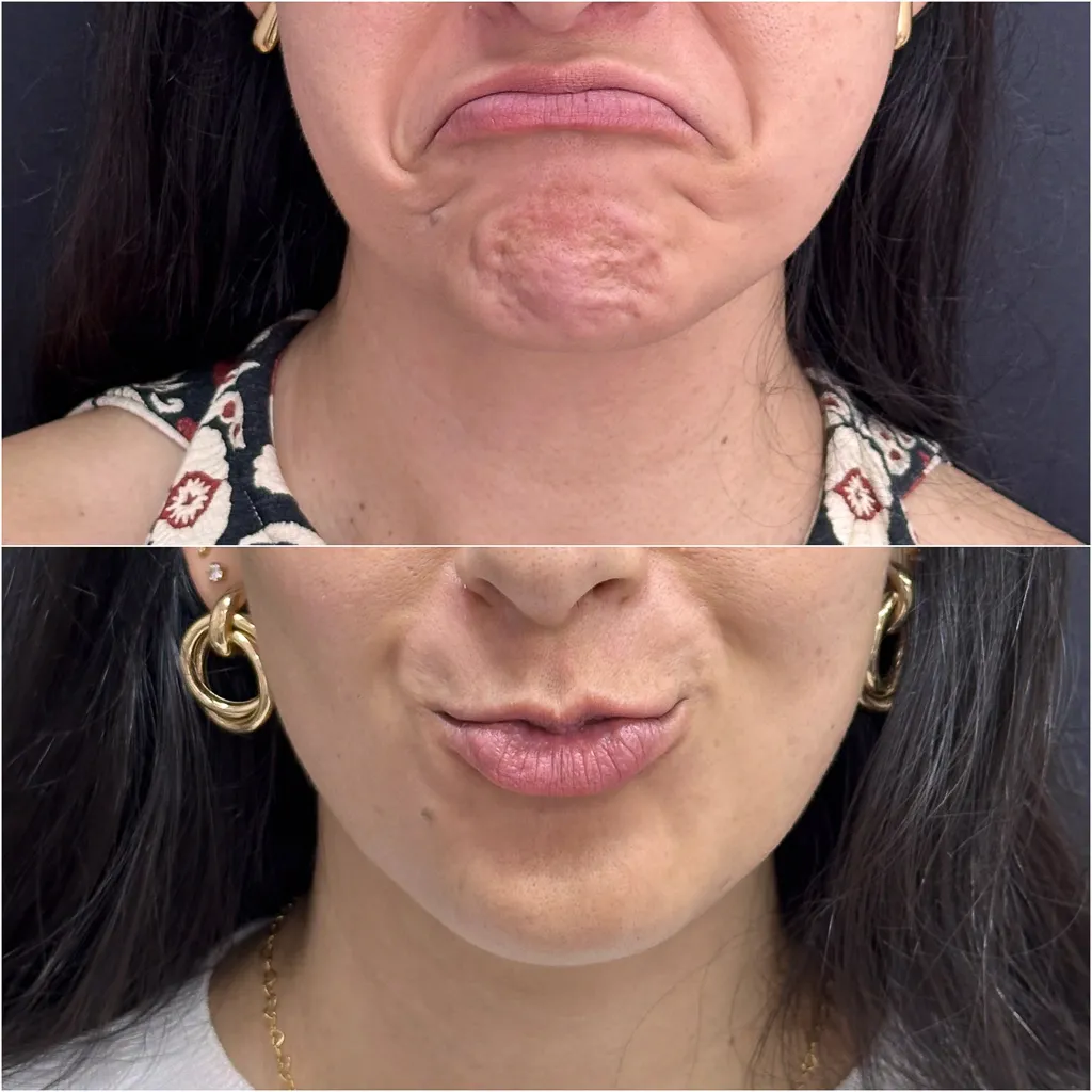 FULLFACE