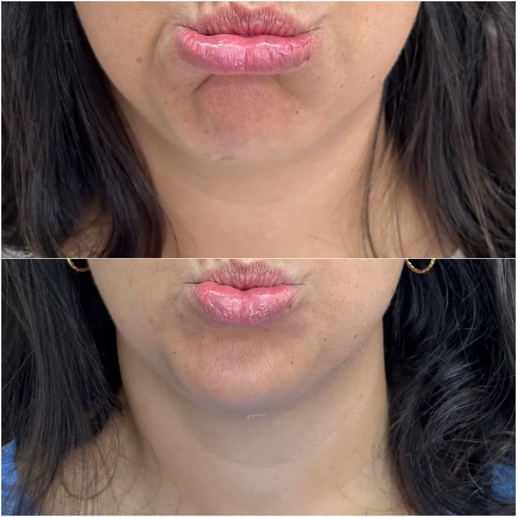FULLFACE