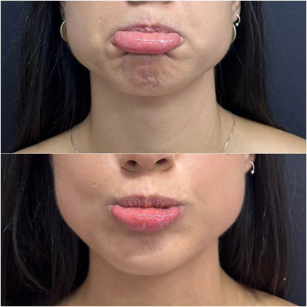 FULLFACE