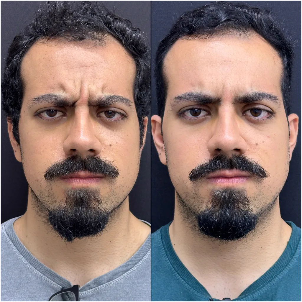 TERÇO SUPERIOR