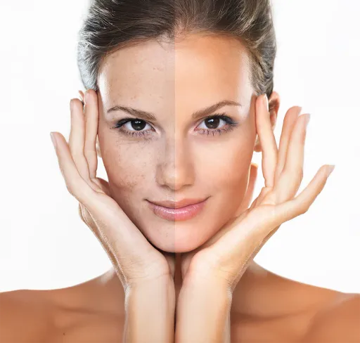 imagem do procedimento